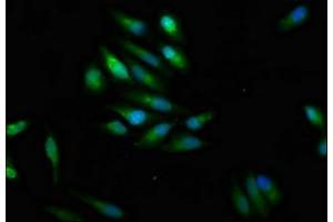 Immunofluorescence staining of Hela cells with ABIN7169929 at 1:100, counter-stained with DAPI. (SCN9A anticorps  (AA 1849-1988))