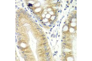 Immunohistochemistry of paraffin-embedded human colon using CES2 antibody (ABIN5970708) at dilution of 1/100 (40x lens). (CES2 anticorps)