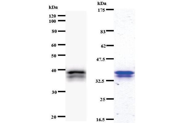 CHD6 anticorps