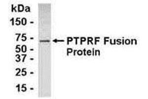 Western Blotting (WB) image for anti-Protein Tyrosine Phosphatase Receptor Type F (PTPRF) (AA 1151-1225) antibody (ABIN2467995) (PTPRF anticorps  (AA 1151-1225))