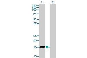 Lane 1: RAG1AP1 transfected lysate ( 19 KDa) Lane 2: Non-transfected lysate. (RAG1AP1 293T Cell Transient Overexpression Lysate(Denatured))