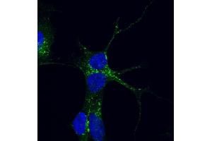 Immunofluorescence (IF) image for anti-Vacuolar Protein Sorting 35 (VPS35) antibody (ABIN5906217) (VPS35 anticorps)