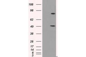 HEK293T cells were transfected with the pCMV6-ENTRY control (Left lane) or pCMV6-ENTRY PSMC3 (Right lane) cDNA for 48 hrs and lysed. (PSMC3 anticorps)