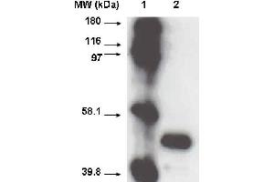 Western blot using CYP2A6 antibody  on recombinant cytochrome p450 at 1 µg/ml. (CYP2A6 anticorps  (C-Term))