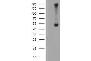 HEK293T cells were transfected with the pCMV6-ENTRY control (Left lane) or pCMV6-ENTRY C20orf3 (Right lane) cDNA for 48 hrs and lysed. (APMAP anticorps)