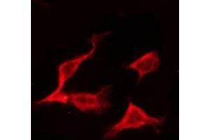 ABIN6275167 staining Hela by IF/ICC. (ERAS anticorps  (C-Term))