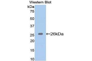 Western Blotting (WB) image for anti-BH3 Interacting Domain Death Agonist (BID) (AA 1-195) antibody (ABIN1077862) (BID anticorps  (AA 1-195))