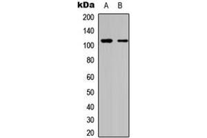 Western blot analysis of DAXX expression in HeLa (A), A549 (B) whole cell lysates. (DAXX anticorps  (C-Term))