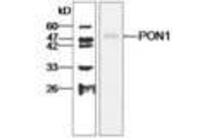 Image no. 1 for anti-Paraoxonase 1 (PON1) antibody (ABIN791456) (PON1 anticorps)