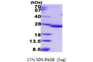 SDS-PAGE (SDS) image for IdnK Gluconokinase Homolog (IDNK) (AA 1-187) protein (His tag) (ABIN668011) (IdnK Protein (AA 1-187) (His tag))