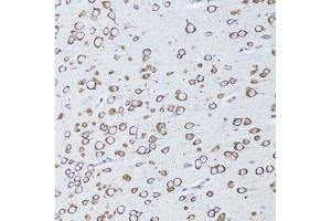 Immunohistochemistry of paraffin-embedded mouse brain using TNFRSF11A antibody (ABIN6290165) at dilution of 1:100 (20x lens). (TNFRSF11A anticorps)