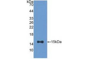 Detection of Recombinant ACO1, Human using Polyclonal Antibody to Aconitase 1 (ACO1) (Aconitase 1 anticorps  (AA 458-586))