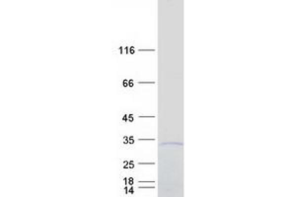 C2orf88 Protein (Transcript Variant 1) (Myc-DYKDDDDK Tag)