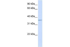 ALDOC antibody used at 1 ug/ml to detect target protein. (ALDOC anticorps  (C-Term))