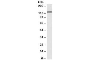 Western blot testing of HeLa lysate with OSMR antibody at 0. (Oncostatin M Receptor anticorps)