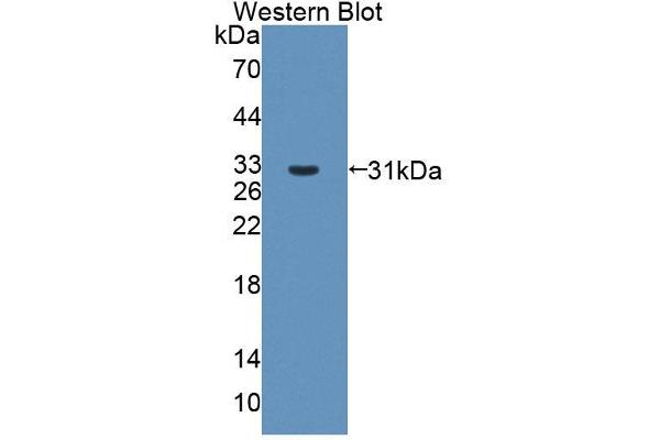 ABCB6 anticorps  (AA 590-842)