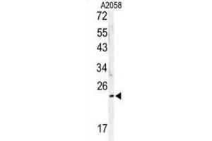 Western Blotting (WB) image for anti-MOB1, Mps One Binder Kinase Activator-Like 1B (MOBKL1B) antibody (ABIN3003175) (MOB1A anticorps)