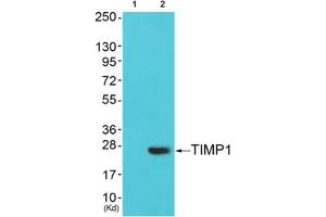 Western blot analysis of extracts from cos-7 cells (Lane 2), using TIMP1 Antibody. (TIMP1 anticorps  (Internal Region))