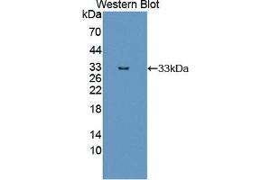 Detection of Recombinant ErbB3, Human using Polyclonal Antibody to V-Erb B2 Erythroblastic Leukemia Viral Oncogene Homolog 3 (ErbB3) (ERBB3 anticorps  (AA 709-966))