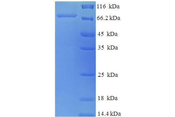 PDIA2 Protein (AA 21-527) (His-SUMO Tag)