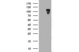 Image no. 1 for anti-Progesterone Receptor (PGR) antibody (ABIN1500186) (Progesterone Receptor anticorps)