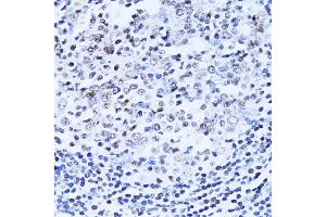 Immunohistochemistry of paraffin-embedded human vermiform appendix using PARP1 Antibody (ABIN5975769) at dilution of 1/100 (40x lens). (PARP1 anticorps)