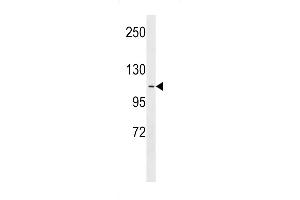 Western blot analysis in A549 cell line lysates (35ug/lane). (APOB anticorps  (AA 596-622))