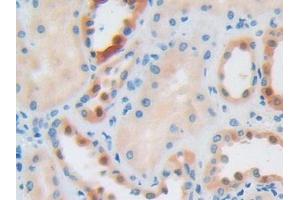 IHC-P analysis of Human Kidney Tissue, with DAB staining. (IGF2R anticorps  (AA 2167-2442))