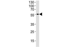 Western blot analysis of human brain tissue lysate using DCX antibody at 1:1000. (Doublecortin anticorps  (AA 107-137))