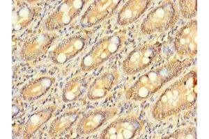 Immunohistochemistry of paraffin-embedded human small intestine tissue using ABIN7176385 at dilution of 1:100 (ZNF562 anticorps  (AA 201-426))