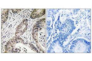 Immunohistochemistry (IHC) image for anti-Terminal Uridylyl Transferase 1, U6 SnRNA-Specific (TUT1) (Internal Region) antibody (ABIN1852324) (TUT1 anticorps  (Internal Region))