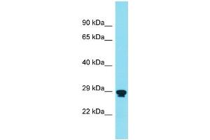 Host: Rabbit Target Name: RNF151 Sample Type: THP-1 Whole Cell lysates Antibody Dilution: 1. (RNF151 anticorps  (Middle Region))