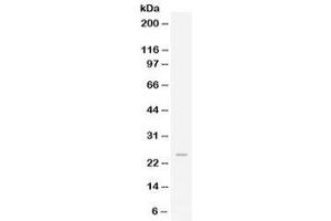 Western blot testing of human HeLa lysate with FGF19 antibody at 0. (FGF19 anticorps)