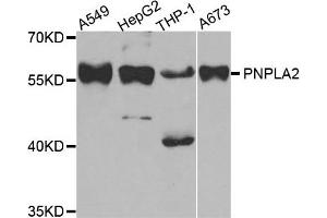 Western Blotting (WB) image for anti-Patatin-Like phospholipase Domain Containing 2 (PNPLA2) antibody (ABIN1882372) (PNPLA2 anticorps)