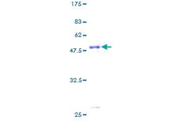 Pallidin Protein (AA 1-172) (GST tag)