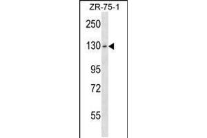 Western blot analysis in ZR-75-1 cell line lysates (35ug/lane). (HKDC1 anticorps  (C-Term))