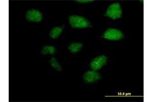 Immunofluorescence of purified MaxPab antibody to ZBTB32 on HeLa cell. (ZBTB32 anticorps  (AA 1-302))