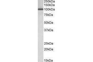 AP21281PU-N NUP107 antibody staining of Peripheral Blood Lymphocytes lysate at 1 µg/ml (35µg protein in RIPA buffer). (NUP107 anticorps  (Internal Region))