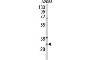 Western Blotting (WB) image for anti-Inhibitor of Growth Family, Member 5 (ING5) antibody (ABIN3004197) (ING5 anticorps)