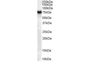 Western Blotting (WB) image for anti-Frizzled Family Receptor 8 (FZD8) (C-Term) antibody (ABIN2465732) (FZD8 anticorps  (C-Term))