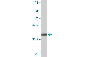 Western Blot detection against Immunogen (37. (Sorting Nexin 1 anticorps  (AA 166-275))