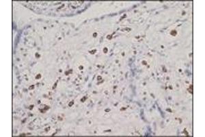 Immunohistochemistry (IHC) image for anti-CD163 (CD163) (N-Term) antibody (ABIN870405) (CD163 anticorps  (N-Term))