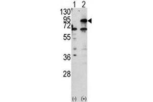 Western blot analysis of CPT1B antibody and 293 cell lysate either nontransfected (Lane 1) or transiently transfected with the CPT1B gene (2). (CPT1B anticorps  (AA 606-637))