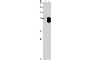 Western Blotting (WB) image for anti-Corticotropin Releasing Hormone Receptor 2 (CRHR2) antibody (ABIN2432883) (CRHR2 anticorps)