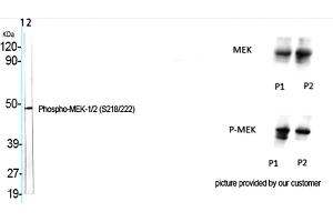 Western Blot analysis of various cells using Phospho-MEK-1/2 (S218/222) Polyclonal Antibody. (MEK1/2 anticorps  (pSer218, pSer222))