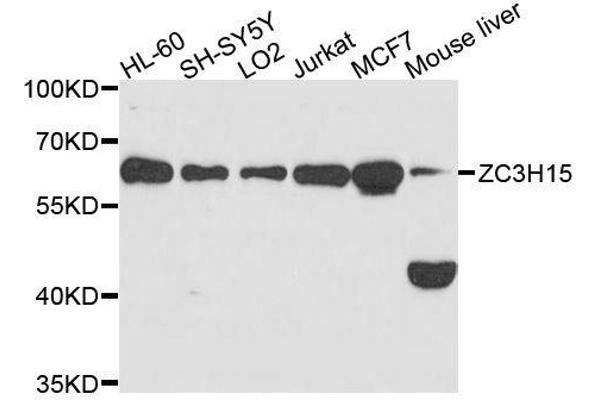 ZC3H15 anticorps  (AA 1-300)