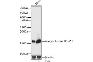 Western blot analysis of extracts of HeLa cells, using Acetyl-Histone H3-K18 antibody (ABIN7267668) at 1:500 dilution. (Histone 3 anticorps  (H3K18))