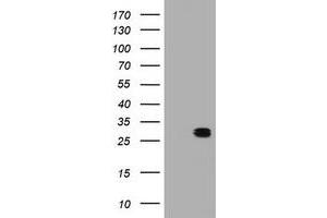 Image no. 1 for anti-B-Cell CLL/lymphoma 10 (BCL10) antibody (ABIN1496851) (BCL10 anticorps)