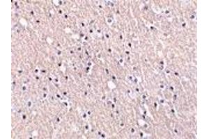 Immunohistochemistry (IHC) image for anti-Cell Death-Inducing DFFA-Like Effector A (CIDEA) (C-Term) antibody (ABIN1030333) (CIDEA anticorps  (C-Term))