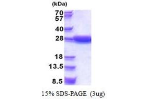 SDS-PAGE (SDS) image for StAR-Related Lipid Transfer (START) Domain Containing 5 (STARD5) (AA 1-213) protein (His tag) (ABIN5853380) (STARD5 Protein (AA 1-213) (His tag))